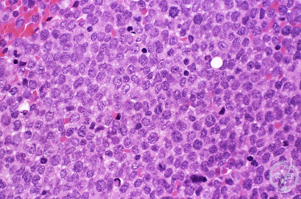 حذاء رياضي FKJM